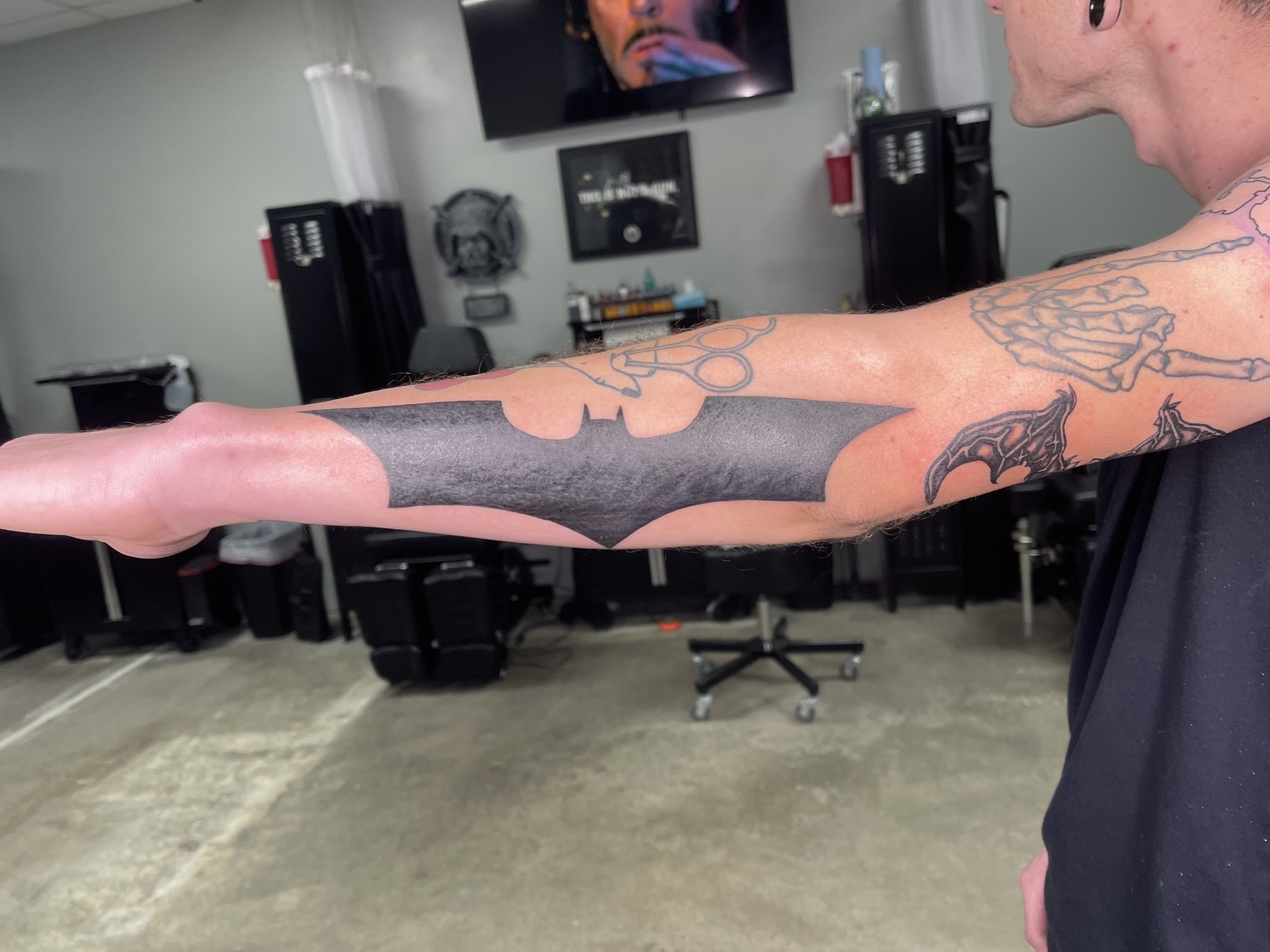 Recovered tattoo view