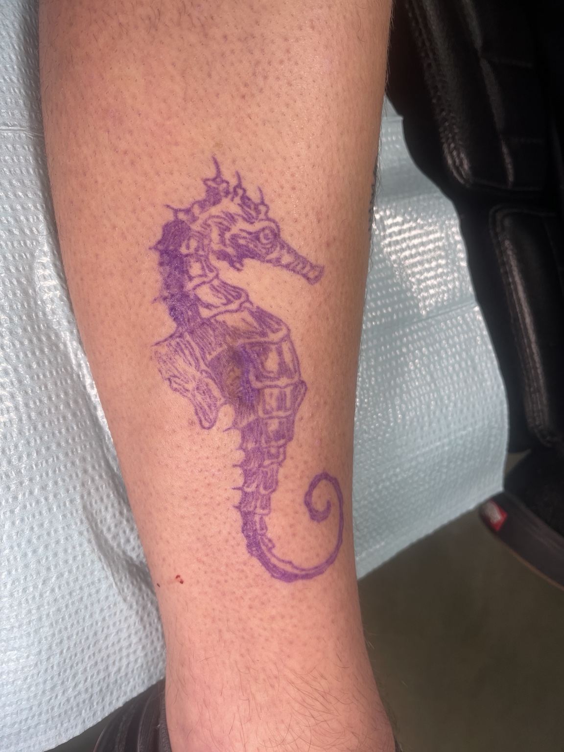 Recovered tattoo view