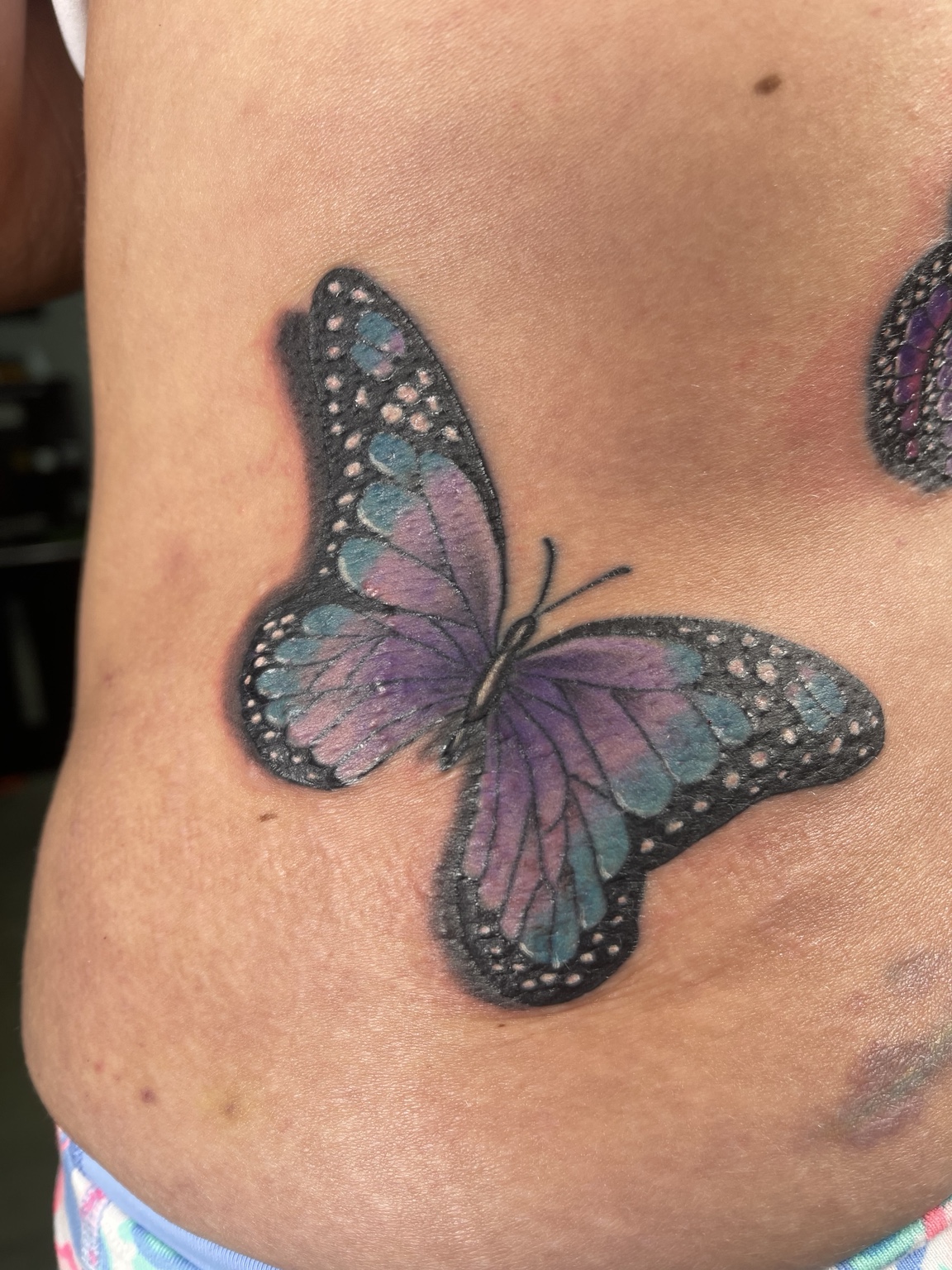 Recovered tattoo view