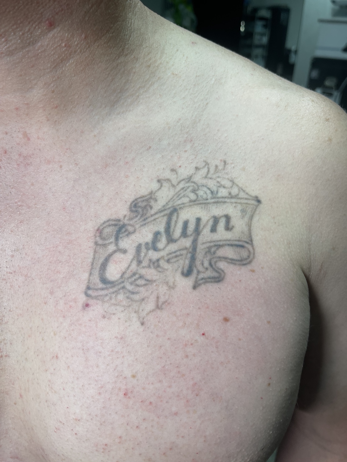 Recovered tattoo still