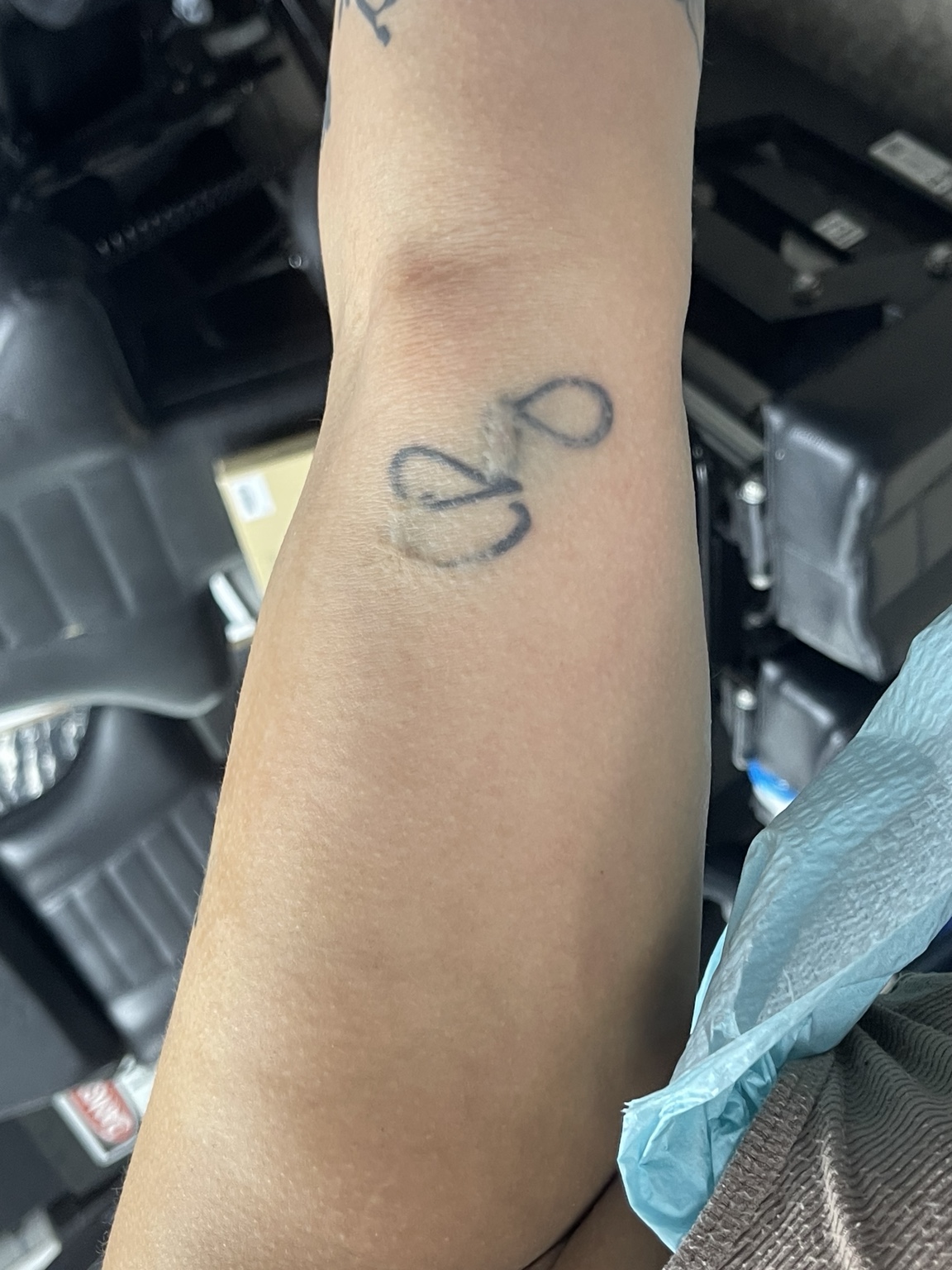 Recovered tattoo still